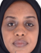 Alaa Ahmed — DHA-licensed General Practitioner