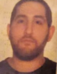 Ahmed El Zahabi — DHA-licensed Anesthesia