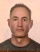 Cyrus Mirshab — DHA-licensed Anesthesia