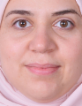 Asma Alskaf — DHA-licensed Neurology