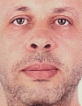 Awny Aly — DHA-licensed Plastic Surgery
