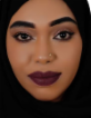 Alaa Mohammed — DHA-licensed General Practitioner