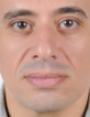 Marco Botros — DHA-licensed Anesthesia