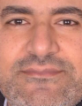 Ayman Elbasyouni — DHA-licensed General Surgery