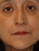 Bindu Pandit — DHA-licensed Anesthesia