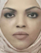 Afraa Habib — DHA-licensed Dermatology