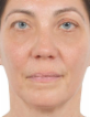 Laure Sophie Christine Revault D Allonnes — DHA-licensed Cardiology