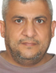 Eyad Ghadir — DHA-licensed Plastic Surgery