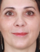 Marta Angela Calatayud Pinuaga — DHA-licensed Ophthalmology