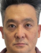 Julio Yoshimura — DHA-licensed Plastic Surgery